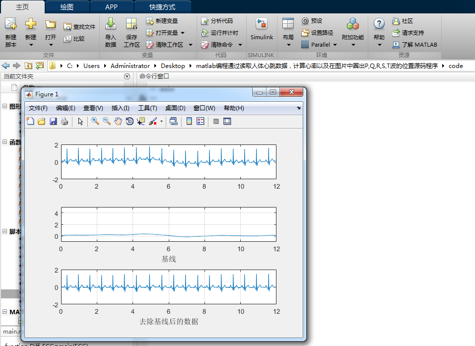 matlabͨȡݣԼͼƬȦP,Q,R,S,TλԴ